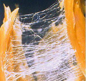 Fascia